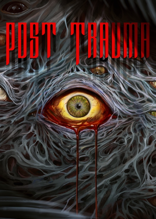 Post Trauma
